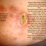 Friday February 26th, 2016 Clove oil made Amazon deep tissue salving weep!